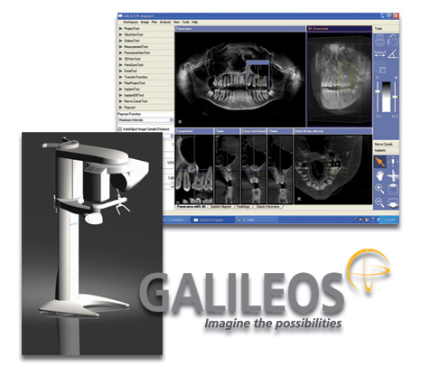 hoe to use galileos viewer software for implnat hoe to use galileos viewer software for implnat